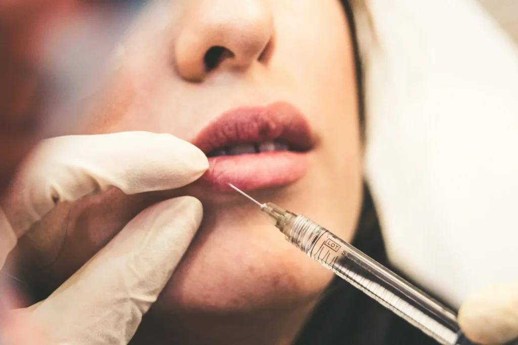 Advanced Lip Injection Course